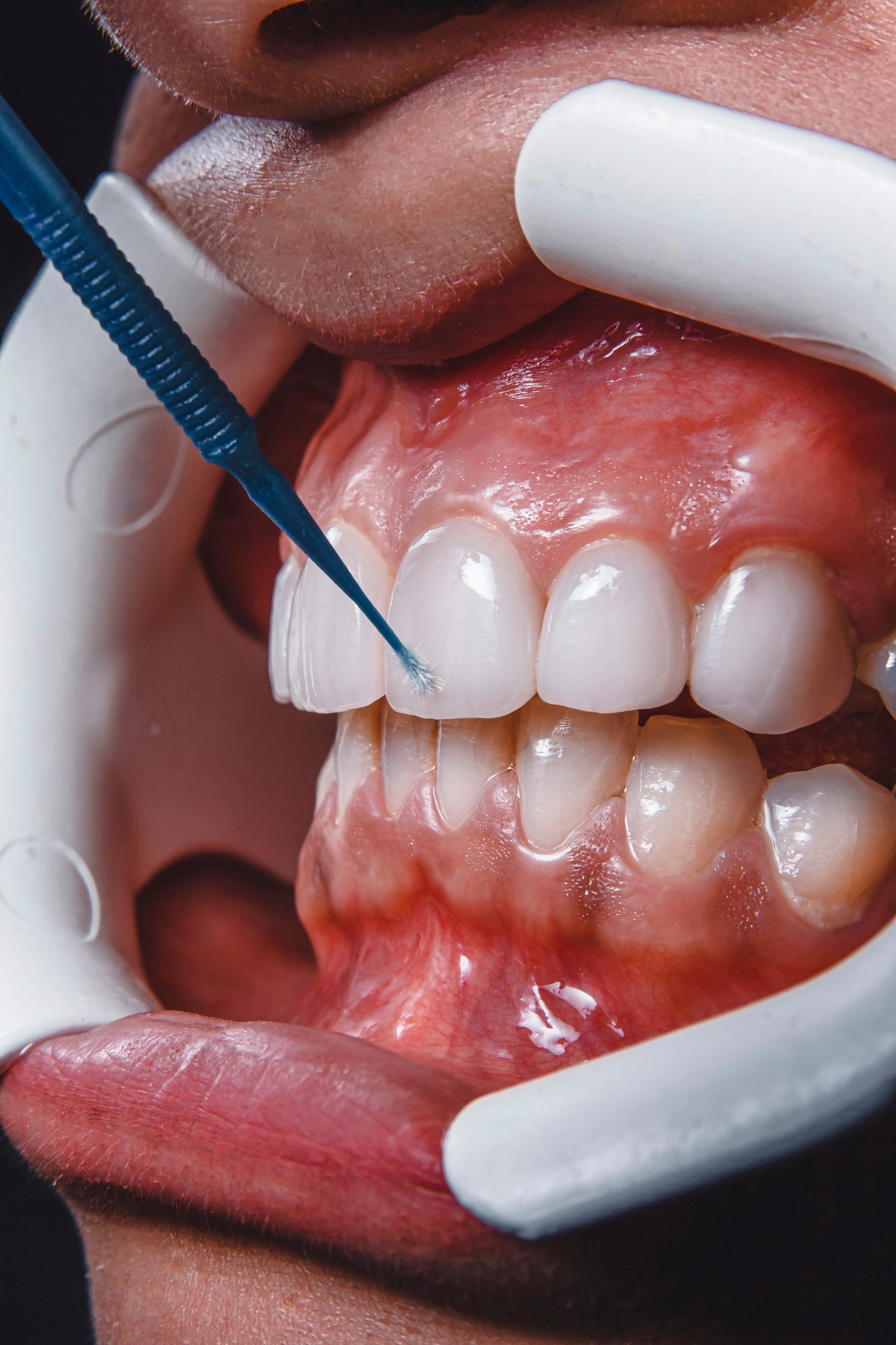 Como a tecnologia digital transforma o sorriso